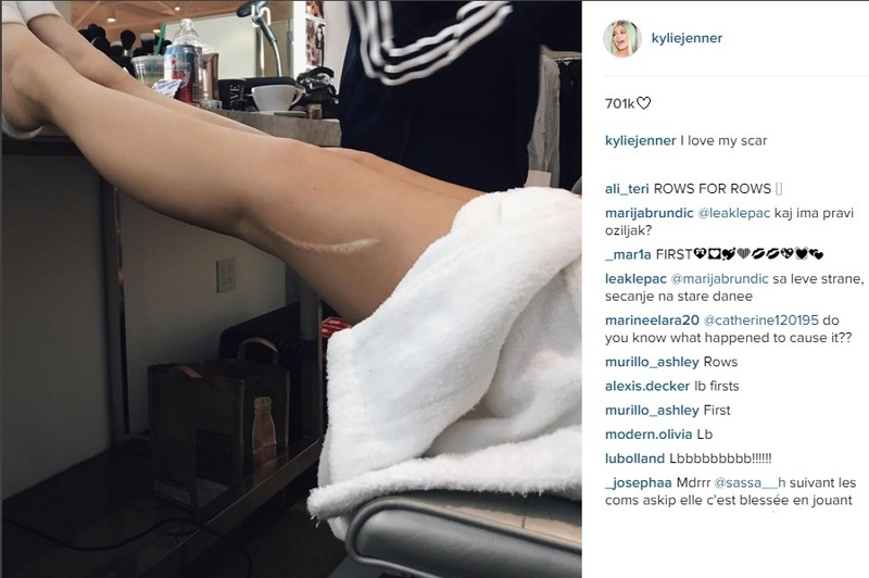 Кайли Дженнер, пост в Instagram